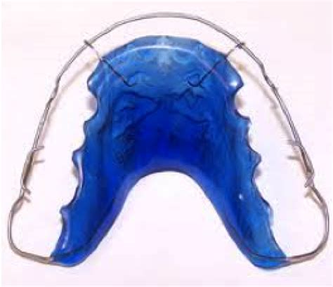 Retainer Types | Orthodontic Arts