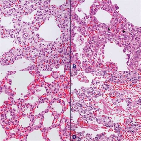 Case Report 2 Necropsy Lung Histology Hematoxylin And Eosin Staining