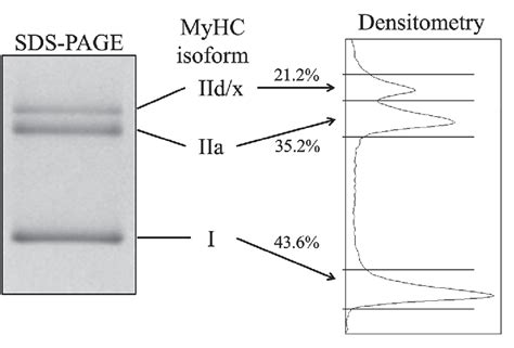 Overview Of Sds Page And Densitometry For Myosin Heavy Chain Myhc