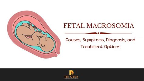 Fetal Macrosomia Causes Symptoms Diagnosis Treatment Fetal