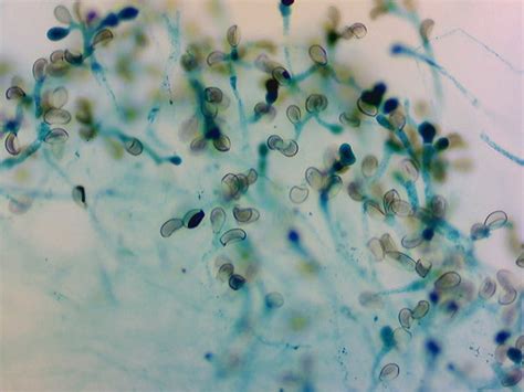 Lab Practical Fungi Flashcards Quizlet