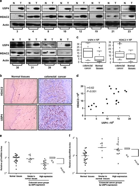 The Expression Of Usp Correlates With That Of Hdac In Cancer Tissues