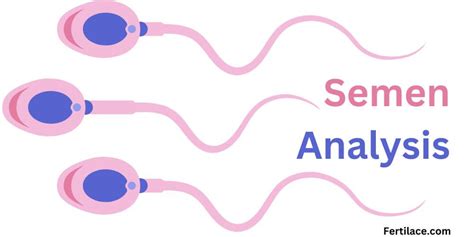 Semen Analysis Easy And Updated February 2024 Fertilace