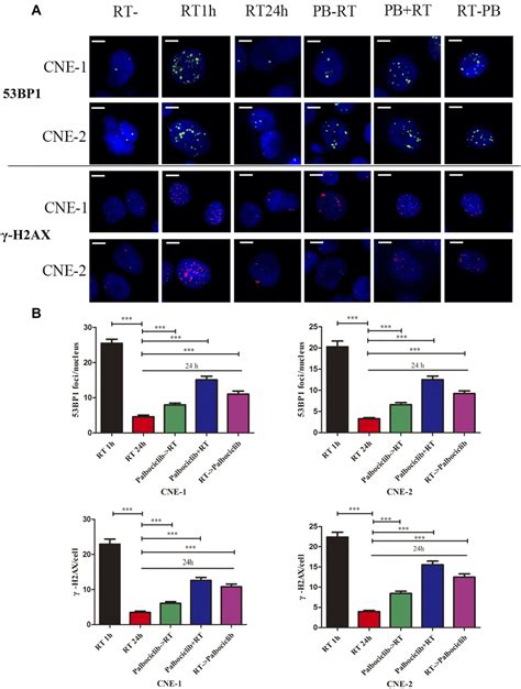 Effect of palbociclib on γ H2AX and 53BP1 foci formation in irradiated