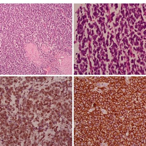 A And B Hematoxylin And Eosin Stained Tissue With 10 × And 40 ×