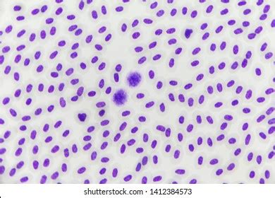 Malaria Parasite Under Microscope View Stock Photo 1412384573 | Shutterstock