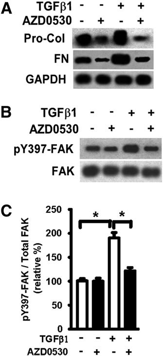 Azd0530 Inhibits Tgf B1induced Procollagen And Fibronectin Expression