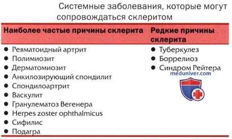 Эписклерит: причины, клиника, диагностика, лечение