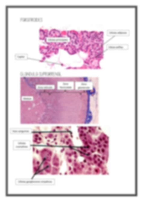 SOLUTION Histologia Ucsm Pr Ctica 7 Sistema Endocrino Studypool