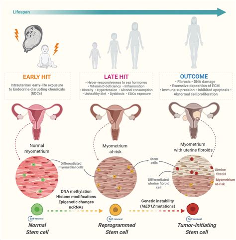 Figure 6 From Comprehensive Review Of Uterine Fibroids Developmental