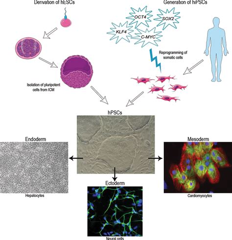 Modeling Hypertrophic Cardiomyopathy With Human Induced Pluripotent