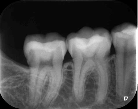 [¿son Necesarias Las Radiografías Dentales ] Clínica Dental Sonríe