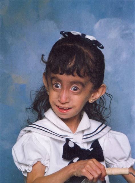 Most Ugliest Boy In The World, The Ugliest Woman In The World Shares