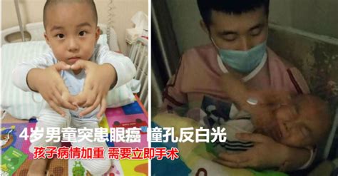 4歲男童突患眼癌 瞳孔反白光嚇壞父母 十多萬的治療費用難倒爸媽 Peekme