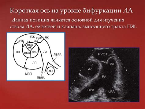 Эхокардиография. История - online presentation
