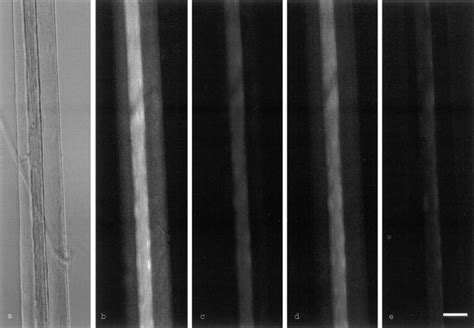 Phase Contrast And Video Autofluorescence Ratio Images Flavoprotein