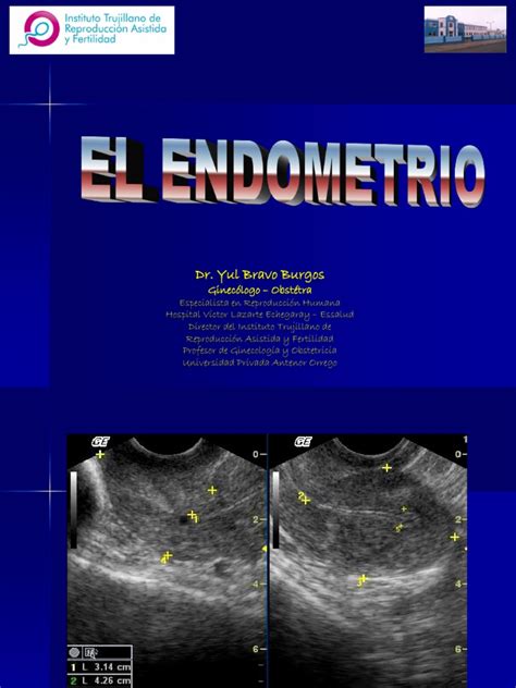 EcografÍa Del Endometrio Útero Ultrasonido Médico