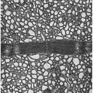 Longitudinal section of myofibril . One sarcomere is shown which has a ...