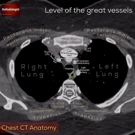 Pet Scan Heart Procedure | Pets Animals US