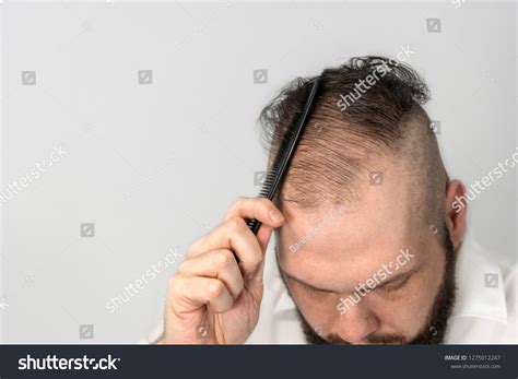 Young Man Combs His Thinning Hair Stock Photo 1275012247 | Shutterstock