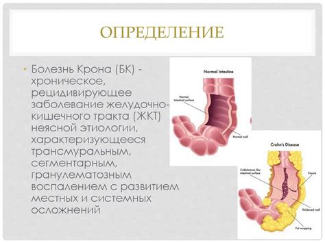 Медицинская реабилитация при болезни Крона - презентация онлайн