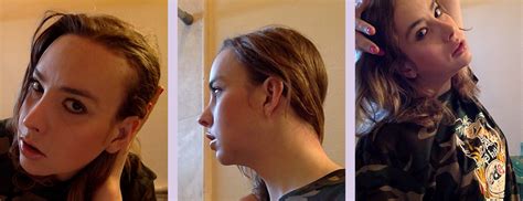 Dr Chettawut Sex Reassignment And Facial Feminization Surgery Center Reduction Rhinoplasty