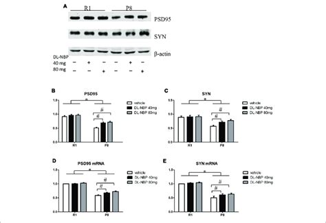 Effects Of Dl N Butylphthalide Dl Nbp Management On Structural