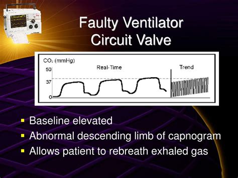 Ppt Capnography And Pulse Oximetry The Standard Of Respiratory