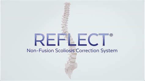 Reflect® Globus Sistema De Corrección De Escoliosis Youtube