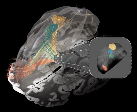 Wie Bremsen Im Gehirn Gelockert Werden K Nnen Charit Mental Health