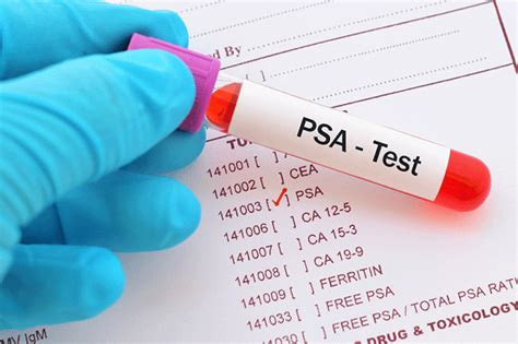 PSA Screening Benefits Disadvantages And Guidelines University