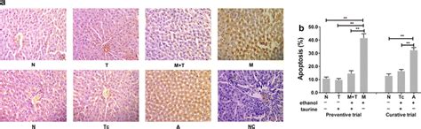 Effects Of Taurine On Apoptosis In The Livers Of Ald Rats A Tunel