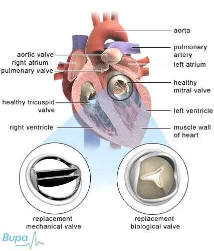 Open Heart Surgery Mayo Clinic Care Network