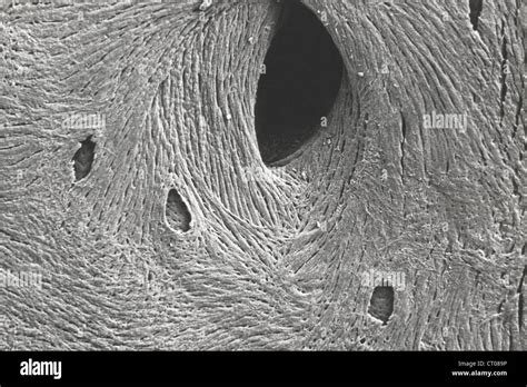 Alveoli micrograph hi-res stock photography and images - Alamy