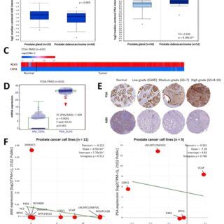 Aim And Psa Expression Levels Are Inversely Correlated In Patients With