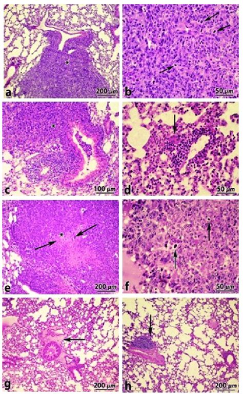 Histological Examinations Of Hande Stained Lung Tissues Sections From The