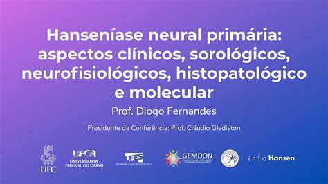 Hanseníase Neural Primária Dr Diogo Fernandes YouTube