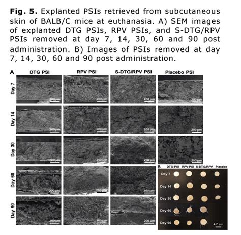 Biodegradable Polymeric Solid Implants For Ultra Long Acting Delivery