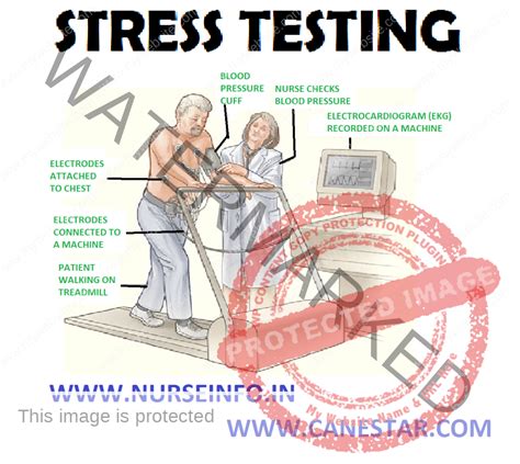 Stress Testing Nurse Info