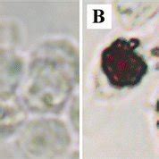 Oil Red O Stained Raw Cells Without Ox Ldl A And With Ox Ldl