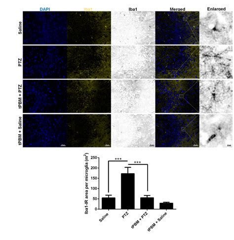 Effects Of Tpbm On Microgliosis In Ca Microglia Stained By Iba Are