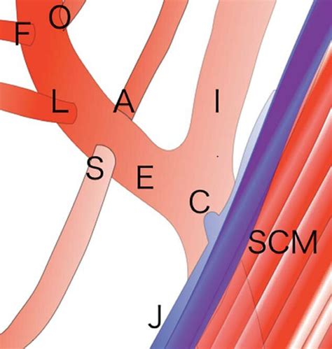 Schematic Depiction Of The Usual Bifurcation Pattern Of The Common Download Scientific Diagram