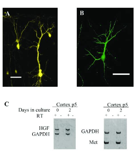 A Epifluorescence Photomicrograph Of Layer And Iii Pyramidal