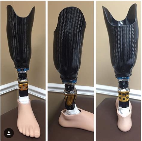 Adult Prosthetics — Orthotics And Prosthetics