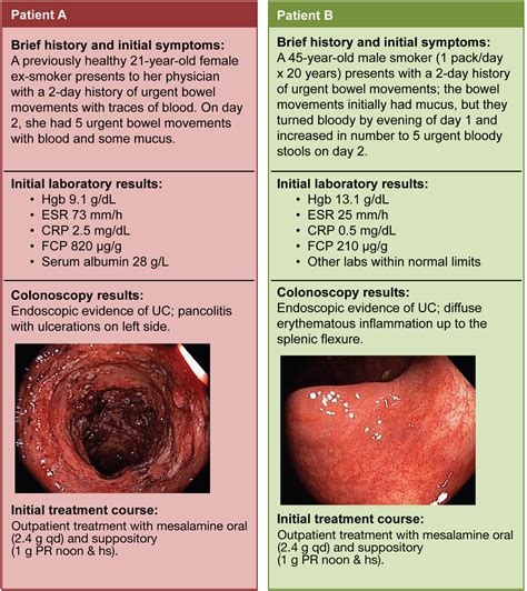 Factors Associated With Poor Outcomes In Adults With Newly Diagnosed