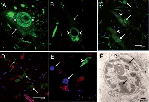 Phospho Tau Protein Expression In The Cell Cycle Of SH SY5Y