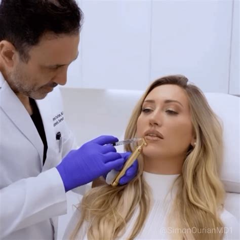 Taking A Leap Forward In Lip Aesthetics Dr Simon Ourian Excels With