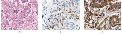 Example Histological Stains A Hematoxylin And Eosin B Ihc Staining