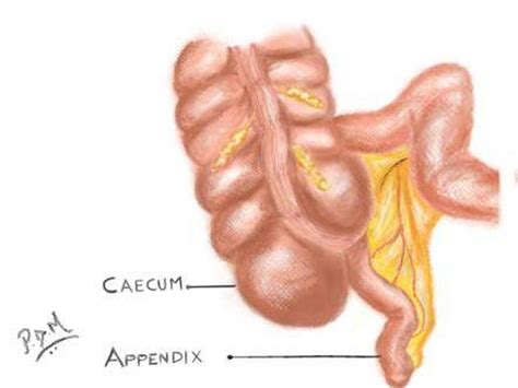 Pictures Of Caecum Healthiack