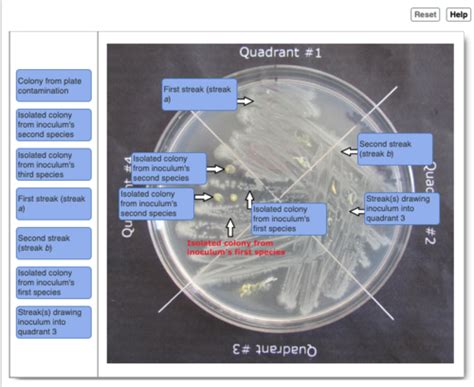 Lab 5: Streak Plate Isolation, Quantifying Bacteria, and Basic Media ...